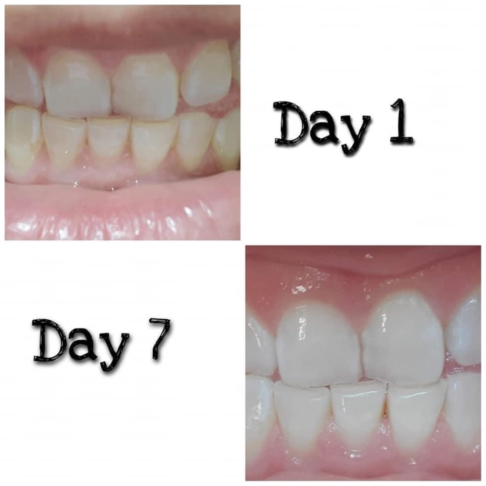 Teeth whitening toothpaste